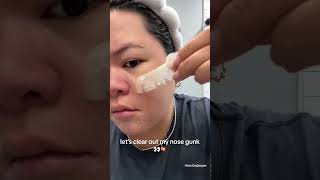 Do Nose Patches Really Work skincare pimplepatch pimplepopping pimplepoppingasmr [upl. by Hugues]