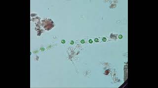 Microspora cells becoming flagellated Zoospores  real time [upl. by Revned]