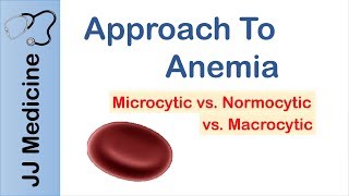 Anemia  Microcytic vs Normocytic vs Macrocytic [upl. by Lumpkin]