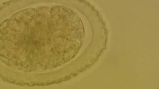 Fertilised corticated egg of Ascaris lumbricoides [upl. by Airakaz]