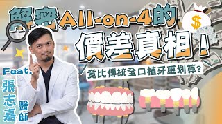 解密Allon4從30萬到100萬的價差真相！總整理傳統全口植牙、活動假牙、Allon4比較表格 Ft張志嘉醫師【品悅牙醫】 [upl. by Nayrb]