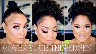 How To Cover Your Bald Thin Edges Traction Alopecia [upl. by Tildy]