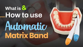 What is amp How to use Automatic Matrix Band  SuperEndo [upl. by Pauiie]