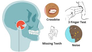 Is Your Jaw UNBALANCED  Uneven Jaw Causes Treatments MUST KNOW [upl. by Anairol772]