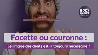 SOINS DENTAIRES  🦷 Facettecouronne  Le limage des dents estil toujours nécessaire   BODYEXPERT [upl. by Aiem]