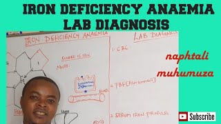 Iron Deficiency Anaemia  Causes amp Signs  Lab diagnosis  Hematology [upl. by Tuck]