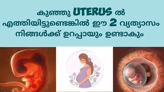 Early Pregnancy Symptoms Deechus world Malayalam [upl. by Ariela379]