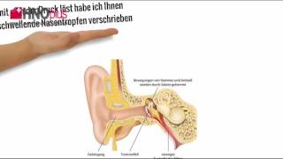 Behandlung des Ohrendruck [upl. by Guinn]