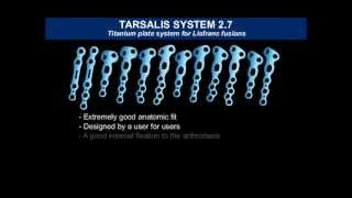 TARSALIS System 27  Introduction ENG [upl. by Sparky]