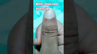 White Lunula Chand significance  Signs in Hand Dikki Palmistry astrology lucky sign [upl. by Ellimaj]