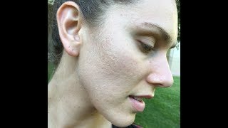 Why I Wash My Face With Dr Bronners Castile Soap Acne Prone Skin PH Acid Oil etc [upl. by Abbot425]