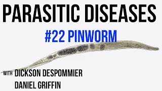 Parasitic Diseases Lectures 22 Pinworm [upl. by Oigroeg97]