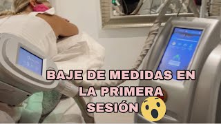 BAJA MEDIDAS EN LA PRIMERA SESION DE CRIOLIPOLISIS ANTES Y DESPUES   LIPO SIN BISTURI  ORIGIMENEZ [upl. by Ilwain31]