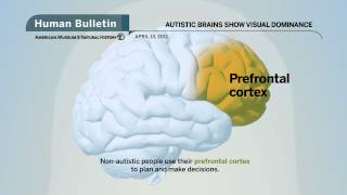 Science Bulletins Autistic Brains Show Visual Dominance [upl. by Aeneg339]