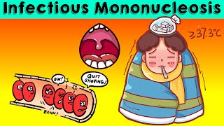 Infectious Mononucleosis IMNGlandular Fever  Causes Signs amp Symptoms Diagnosis amp Treatment [upl. by Onimixam698]