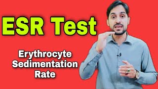 ESR Test  Erythrocyte Sedimentation Rate  High ESR Causes [upl. by Uile]