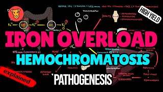 HEMOCHROMATOSIS Pathogenesis Mechanism of clinical symptoms Diagnostic criteria Treatment [upl. by Haduhey525]