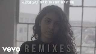 Alessia Cara  Scars To Your Beautiful NOTD Remix  Official Audio [upl. by Adnilreb862]