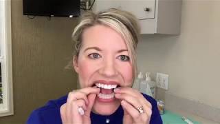 Teeth Whitening Instructions [upl. by Christianna]