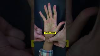 Simple Test to Check If Your Hand Is at Risk [upl. by Ysabel]