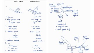 DIRECT VS INDIRECT INGUINAL HERNIA NOTES  ONE PAGE NOTE HERNIA SURGERY  4TH PROFF  MBBS [upl. by Mackenie996]