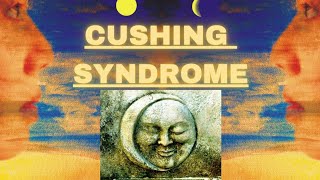 Cushing syndrome  Easiest diagnostic algorithm and Dexamethasone suppression test [upl. by Marcille]