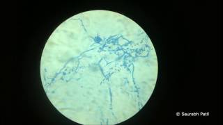 Trichophyton rubrum Lactophenol cotton blue mount [upl. by Tenej]