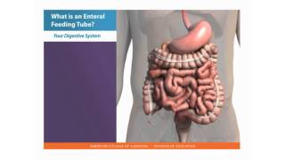 Gastrostomy Tube Training Part 1  Introduction [upl. by Lymann]