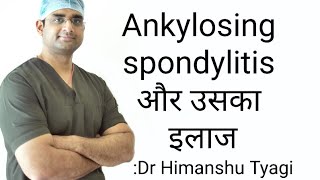 Ankylosing spondylitis और उसका इलाजTreatment [upl. by Laenaj]