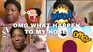 What Happened on Day 2 PostNose Piercing healing nosepiercing [upl. by Billen32]