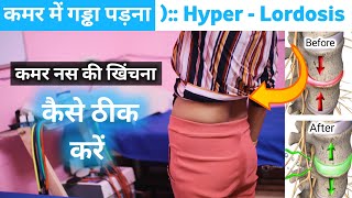 कमर के गड्ढे को कैसे ठीक करें  anterior pelvic tilt Correction exercises  hyperlordosis treatment [upl. by Gnuh]