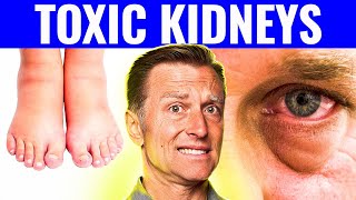 7 Warning Signs That Your Kidneys Are Toxic [upl. by Atikam]