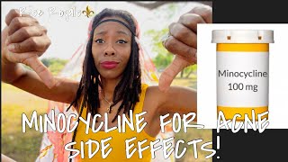 MINOCYCLINE FOR ACNE🤨  STORYTIME  SIDE EFFECTS  GODDESS PLATINUMM [upl. by Acinnad]