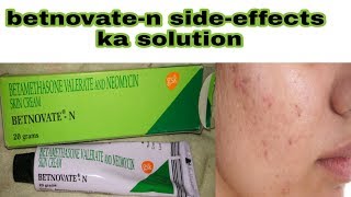 betnovate n cream ke sideeffects ka solution  how to use betnovate n cream  hindi [upl. by Kcirdorb]