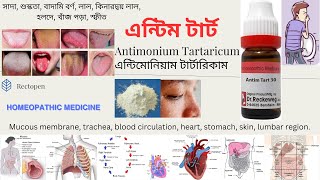 08 Antimonium Tartaricum l এন্টিম টার্ট l মেটেরিয়া মেডিকা l Materia Medical Learn Antim Tart easily [upl. by Derzon]