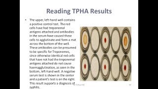 TPHA TestPositive [upl. by Tohcnarf]