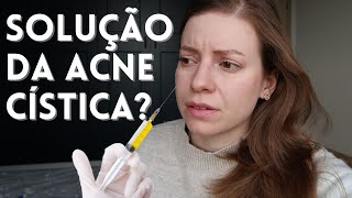 Injeção de Cortisona para Espinha Interna Prós e Contras que Você Deve Conhecer [upl. by Rockey]