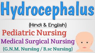 Hydrocephalus In Hindi  Hydrocephalus In Pediatric Nursing [upl. by Corena]