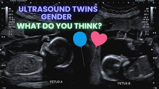 Ultrasound Pregnancy Twins Gender Identification Special interaction between the twins ❤️ [upl. by Annaig235]