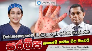 එක්කෙනෙකුගෙන් 18 දෙනෙකුට පමණ පැතිරෙන සරම්ප ලංකාවේ නැවත හිස ඔසවයි [upl. by Bluefarb59]