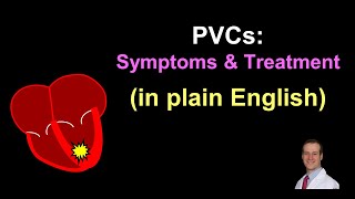 PVCs Symptoms and Treatment  in Plain English [upl. by Anthe]