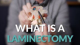 What is a Laminectomy  Spine Surgery Basics [upl. by Aineles]