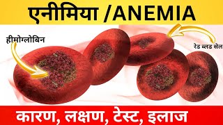 एनीमिया  anemia क्यों होता है Iron ki kami se hone wala anemia iron deficiency anemia [upl. by Kaylyn]