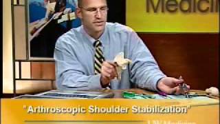 Arthroscopic Shoulder Stabilization [upl. by Sergeant567]