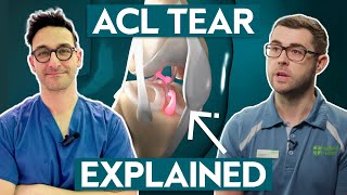 What is an ACL injury  Knee Surgeon and Physio Explain [upl. by Ysnap]