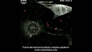 Tumorderived extracellular vesicles uptake in mouse brain endothelial cells [upl. by Ariaj]