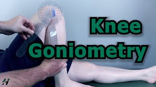 Knee Goniometry [upl. by Idalia]