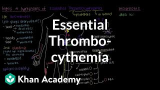 What is essential thrombocythemia  Hematologic System Diseases  NCLEXRN  Khan Academy [upl. by Phyllida]