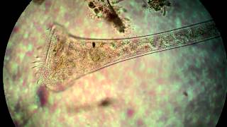 Protist under the microscope [upl. by Remmer]