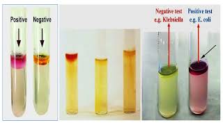 Bacterial Indole Test [upl. by Aicilyt]